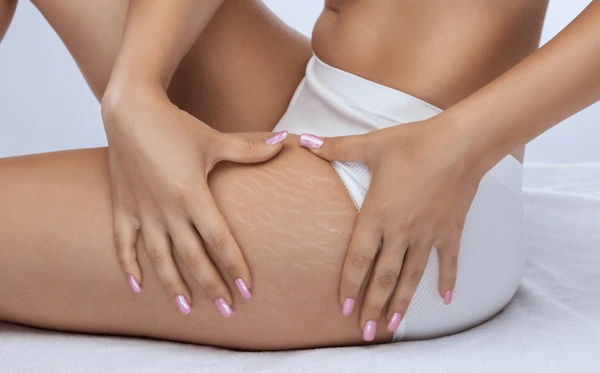 Carbon Laser Treatment in Lucknow